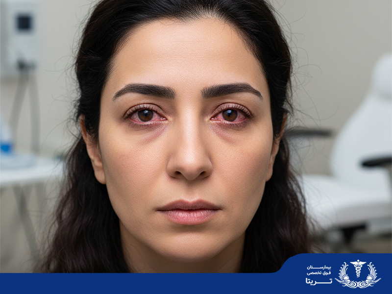 آیا خارش چشم خطرناک است؟