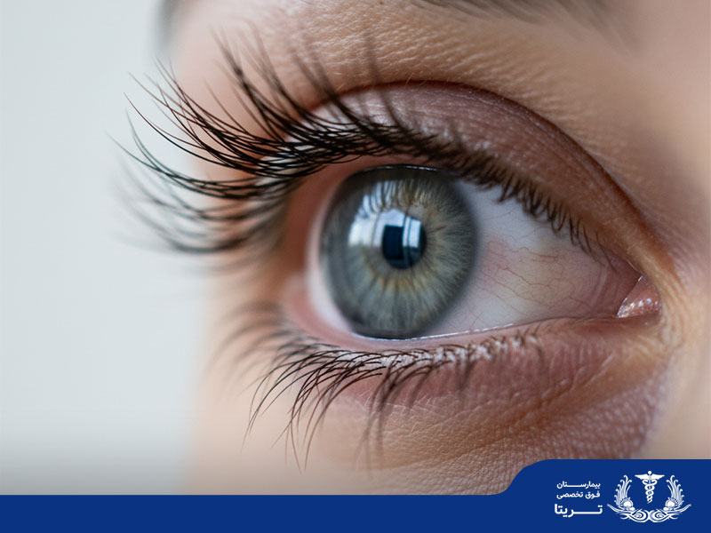 علل خارش چشم چیست؟