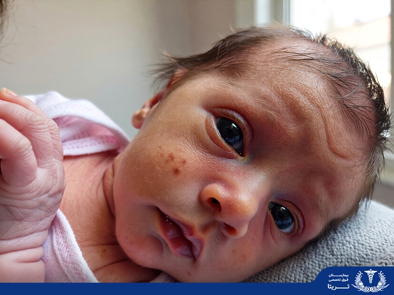چشم نوزاد از کی میبینه