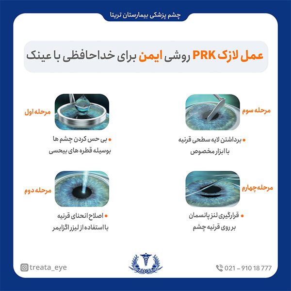prk-safety عملا لازک PRK روشی ایمن برای خداحافظی با عینک
